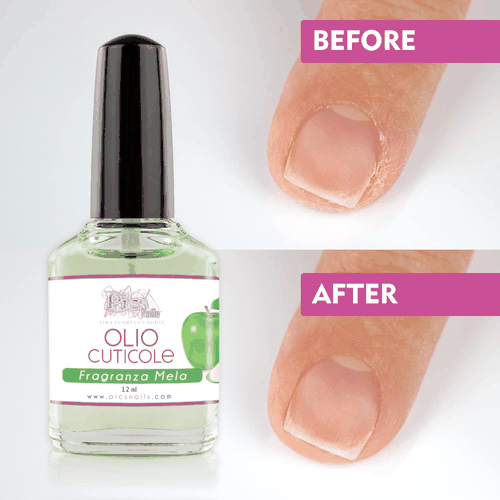 Olio Cuticole Unghie Di Mani E Piedi