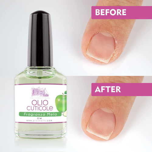 Olio Cuticole Unghie Di Mani E Piedi